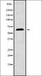Alanine--Glyoxylate Aminotransferase 2 antibody, orb337980, Biorbyt, Western Blot image 