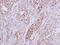 Ribosomal Protein S10 antibody, PA5-21390, Invitrogen Antibodies, Immunohistochemistry frozen image 