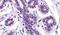 Melanotransferrin antibody, PA5-32920, Invitrogen Antibodies, Immunohistochemistry paraffin image 