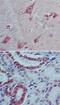 Interleukin 22 antibody, NBP2-27339, Novus Biologicals, Immunohistochemistry frozen image 