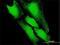 Prefoldin Subunit 5 antibody, H00005204-B03P, Novus Biologicals, Immunofluorescence image 