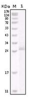 ERBB2 antibody, AM06231SU-N, Origene, Western Blot image 
