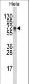 Deltex E3 Ubiquitin Ligase 1 antibody, LS-C167556, Lifespan Biosciences, Western Blot image 