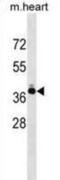 Troponin T2, Cardiac Type antibody, abx028914, Abbexa, Western Blot image 