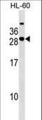 Syntaxin Binding Protein 6 antibody, LS-C157110, Lifespan Biosciences, Western Blot image 