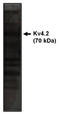 Potassium Voltage-Gated Channel Subfamily D Member 2 antibody, AP05130PU-N, Origene, Western Blot image 