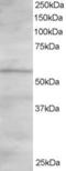 Oxysterol-binding protein-related protein 2 antibody, LS-C55208, Lifespan Biosciences, Western Blot image 