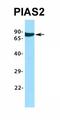 SET And MYND Domain Containing 2 antibody, orb184544, Biorbyt, Western Blot image 