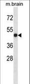 Lymphotoxin Beta Receptor antibody, LS-C163917, Lifespan Biosciences, Western Blot image 