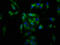 LIF Receptor Subunit Alpha antibody, LS-C670584, Lifespan Biosciences, Immunofluorescence image 