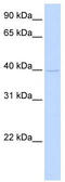 Tropomodulin 2 antibody, TA334550, Origene, Western Blot image 