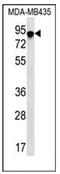 FYN Binding Protein 1 antibody, AP51746PU-N, Origene, Western Blot image 