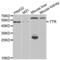 Transthyretin antibody, abx002286, Abbexa, Western Blot image 