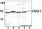 Cancer Antigen 1 antibody, A12728, Boster Biological Technology, Western Blot image 