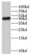GDP-Mannose Pyrophosphorylase B antibody, FNab03527, FineTest, Western Blot image 