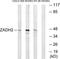 Zinc Binding Alcohol Dehydrogenase Domain Containing 2 antibody, TA316313, Origene, Western Blot image 