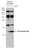 Hemoglobin Subunit Beta antibody, GTX116412, GeneTex, Western Blot image 