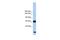 Phosphatidylinositol Glycan Anchor Biosynthesis Class O antibody, A10849, Boster Biological Technology, Western Blot image 