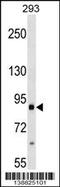 Integrin Subunit Beta 2 antibody, 59-652, ProSci, Western Blot image 