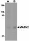 Matrilin 2 antibody, LS-C108487, Lifespan Biosciences, Western Blot image 