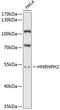 Heterogeneous Nuclear Ribonucleoprotein H2 antibody, 14-733, ProSci, Western Blot image 