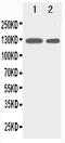 RB Transcriptional Corepressor Like 2 antibody, PA1895, Boster Biological Technology, Western Blot image 