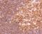 Nuclear Factor Kappa B Subunit 2 antibody, NBP2-66977, Novus Biologicals, Immunohistochemistry paraffin image 