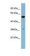 Kallikrein Related Peptidase 10 antibody, NBP1-58249, Novus Biologicals, Western Blot image 