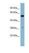Kallikrein Related Peptidase 10 antibody, NBP1-58249, Novus Biologicals, Western Blot image 