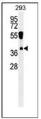 Rhox Homeobox Family Member 2 antibody, AP53663PU-N, Origene, Western Blot image 