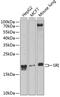 SRI antibody, GTX65950, GeneTex, Western Blot image 