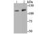 O-GlcNAcase antibody, A03465, Boster Biological Technology, Western Blot image 