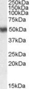 Retinoic Acid Receptor Alpha antibody, PA5-18353, Invitrogen Antibodies, Western Blot image 