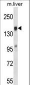 T Cell Lymphoma Invasion And Metastasis 2 antibody, LS-C161871, Lifespan Biosciences, Western Blot image 