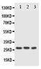Fas Associated Via Death Domain antibody, PA1464, Boster Biological Technology, Western Blot image 