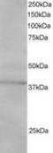 SUMO1 Activating Enzyme Subunit 1 antibody, TA302596, Origene, Western Blot image 