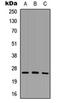 Sodium Channel Modifier 1 antibody, orb234962, Biorbyt, Western Blot image 