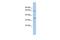 MIF4G Domain Containing antibody, GTX47268, GeneTex, Western Blot image 