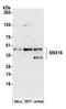 Thioredoxin Related Transmembrane Protein 4 antibody, NBP2-61228, Novus Biologicals, Western Blot image 