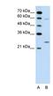 Guanidinoacetate N-methyltransferase antibody, NBP1-54819, Novus Biologicals, Western Blot image 