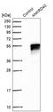 Ankyrin Repeat Domain 40 antibody, HPA021759, Atlas Antibodies, Western Blot image 