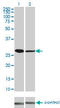 Cyclin Dependent Kinase 4 antibody, LS-C196880, Lifespan Biosciences, Western Blot image 