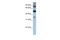 Inositol Polyphosphate-5-Phosphatase B antibody, A07869, Boster Biological Technology, Western Blot image 