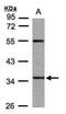 Pantothenate Kinase 3 antibody, NBP1-32638, Novus Biologicals, Western Blot image 