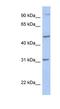 Protein Phosphatase, Mg2+/Mn2+ Dependent 1J antibody, NBP1-56765, Novus Biologicals, Western Blot image 