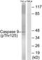 Caspase 9 antibody, PA5-37505, Invitrogen Antibodies, Western Blot image 
