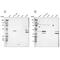 Sarcolemma Associated Protein antibody, PA5-51707, Invitrogen Antibodies, Western Blot image 
