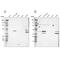 Sarcolemma Associated Protein antibody, PA5-51707, Invitrogen Antibodies, Western Blot image 