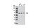 Eukaryotic Translation Initiation Factor 2 Alpha Kinase 2 antibody, 12297S, Cell Signaling Technology, Western Blot image 