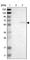 Zinc Finger C3HC-Type Containing 1 antibody, HPA019089, Atlas Antibodies, Western Blot image 